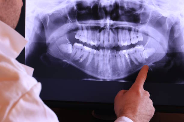 Best Mobile Emergency Dentist in Elgin, IL